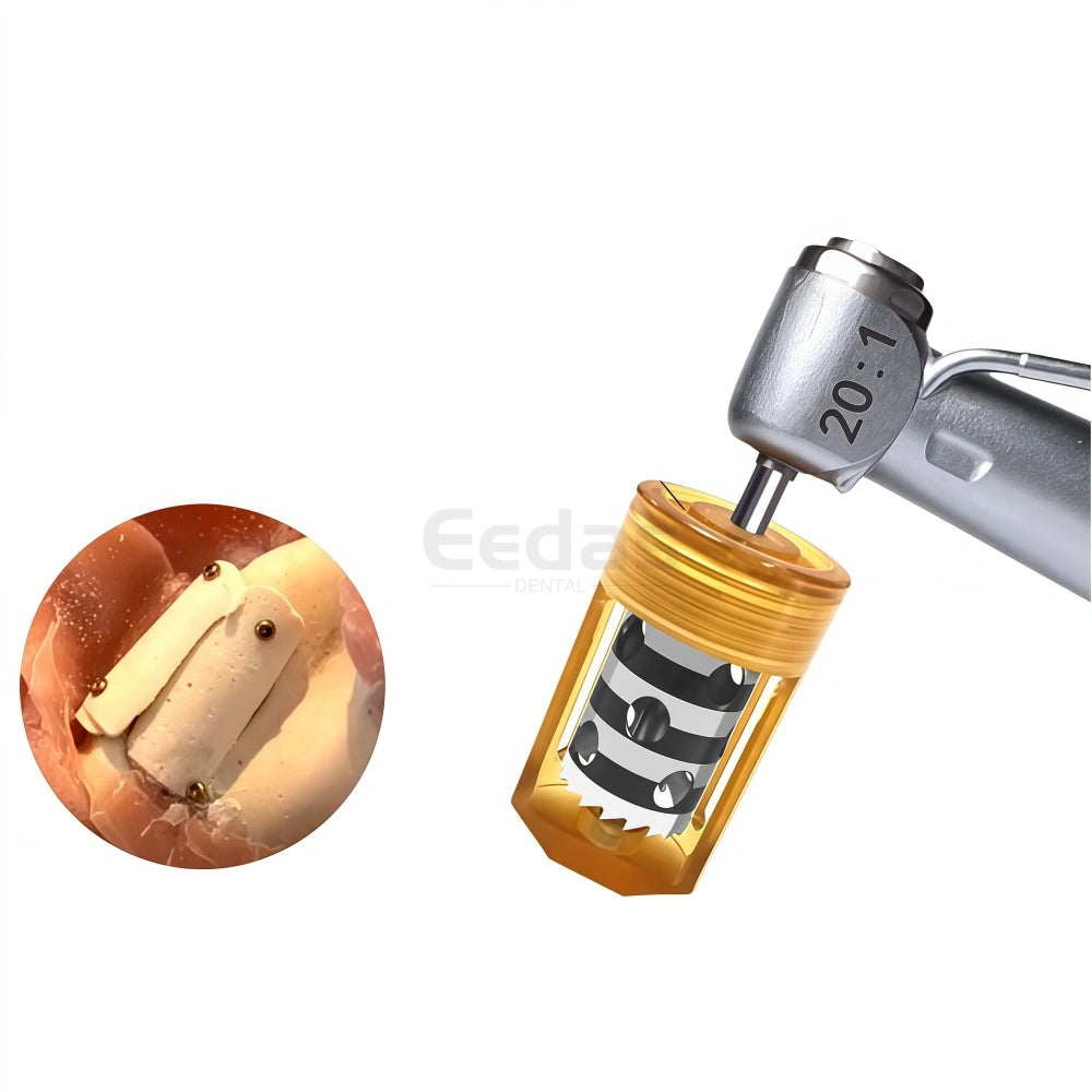 Dental Half Moon Bone Chip Trephine Drill