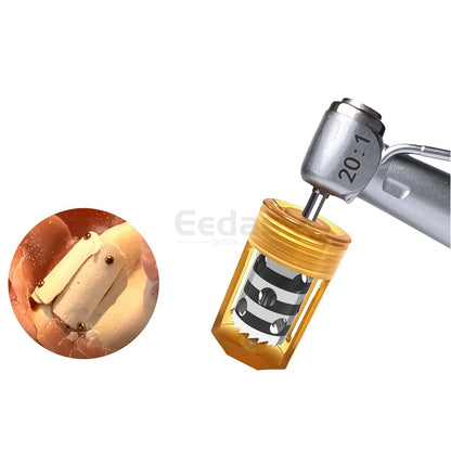 Dental Half Moon Bone Chip Trephine Drill