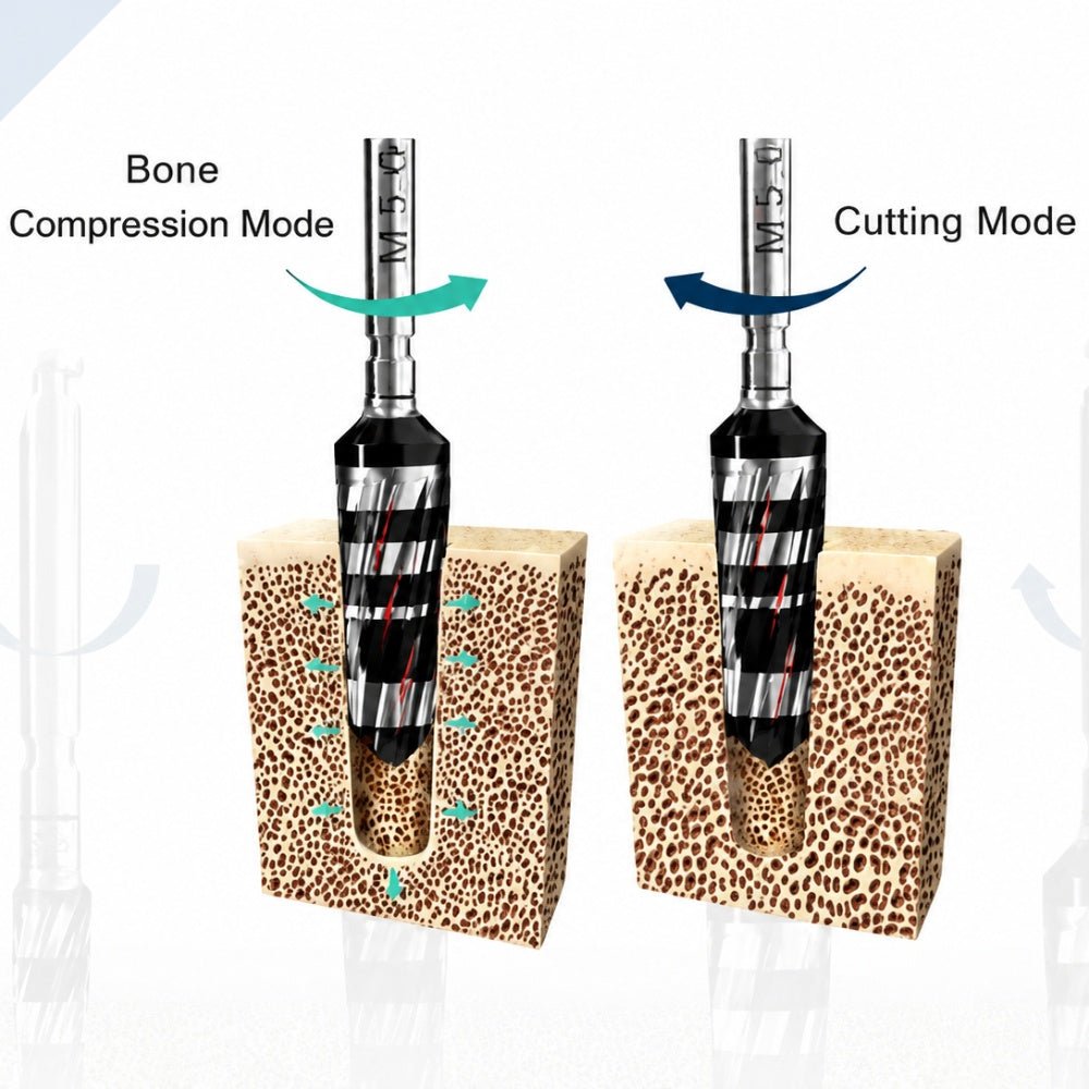1.75 Smart Osseodensification Bur - eedas.com