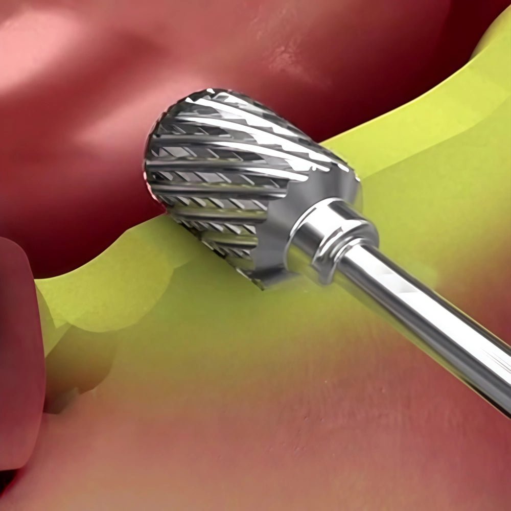 Dental Trimmer Burs Pineapple Drills - EEDAS Dental